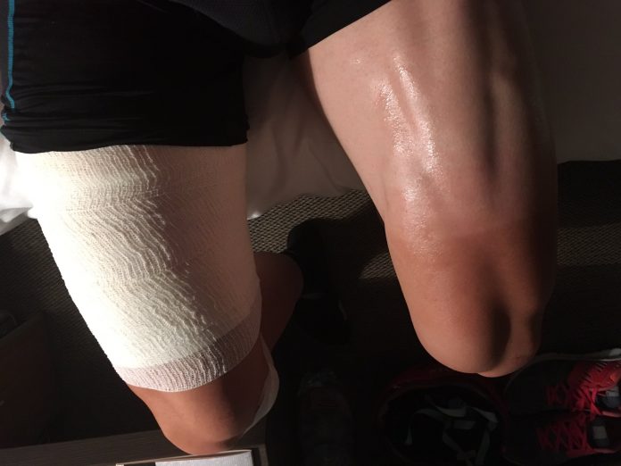 TODAYCYCLING - Les jambes de Michael Morkov hier soir. Photo : Twitter/Michael Morkov.