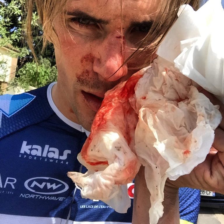 Yoann Offredo victime d’une agression physique à l’entraînement