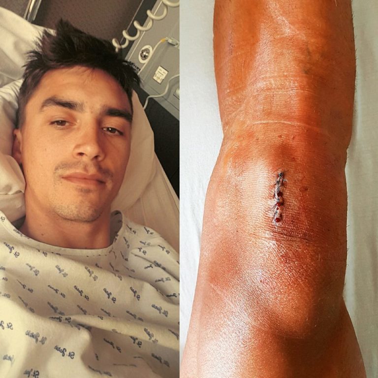Julian Alaphilippe, opéré, déclare forfait pour le Tour de France
