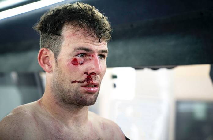 Mark Cavendish blessé au visage