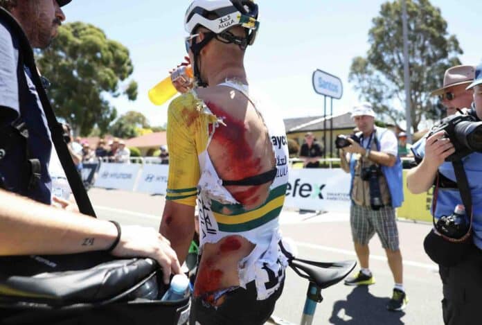 Tour Down Under Luke Plapp chute lourdement