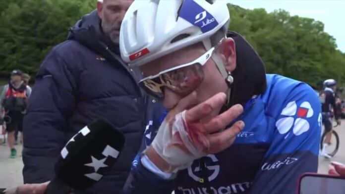 Giro 2025, étape 7 : David Gaudu : « On voit le tendon... c'est pas terrible »